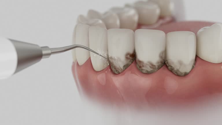 Trusted Dental Implants service in Copperas Cove, TX - Dentist Open Now